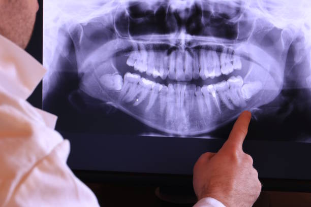 Best Pediatric Emergency Dentist in Grabill, IN