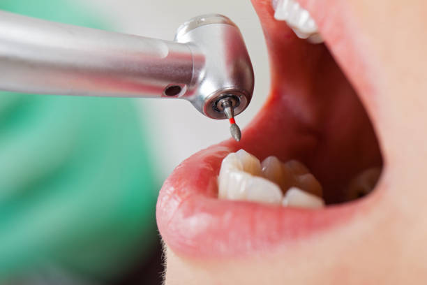 Best Emergency Treatment for Dental Infections or Abscesses in Grabill, IN
